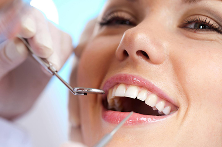 Porcelain veneer consultation in Melbourne CBD